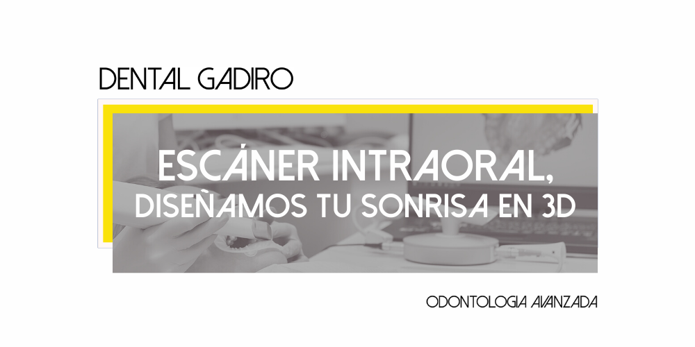 Imagen escaner
